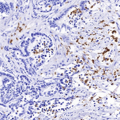 Arginase-1 Recombinant Rabbit mAb (SDT-369-33)