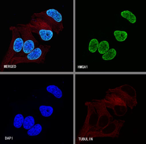 HMGA1 Recombinant Rabbit mAb (S-R332)