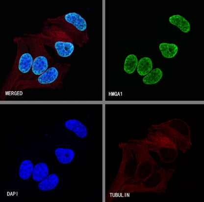 HMGA1 Recombinant Rabbit mAb (S-R332)