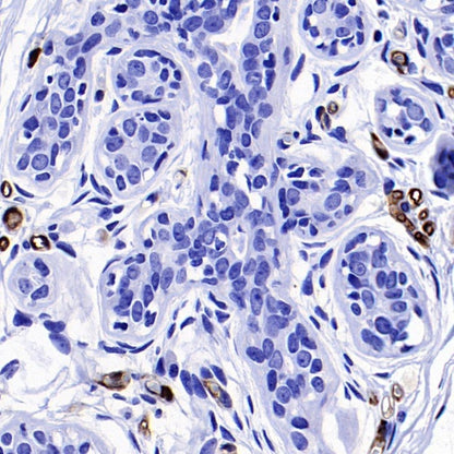 FABP4 Recombinant Rabbit mAb (S-1360-58）