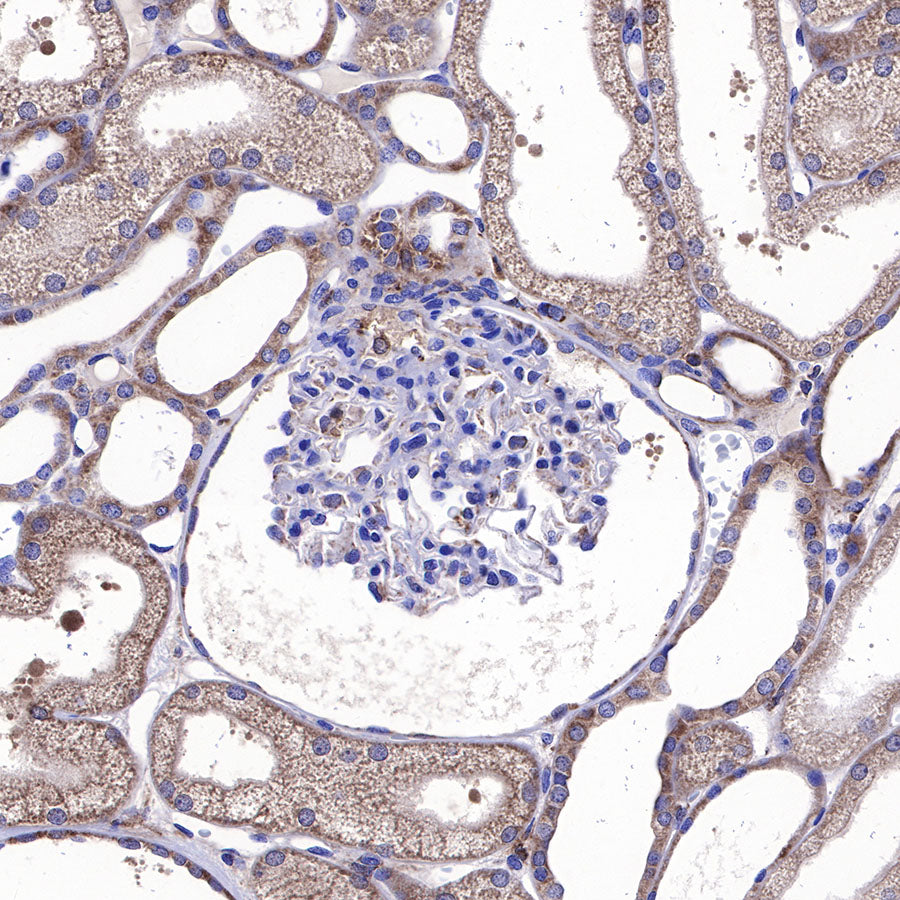 BAX Recombinant Rabbit mAb (SDT-338-76)