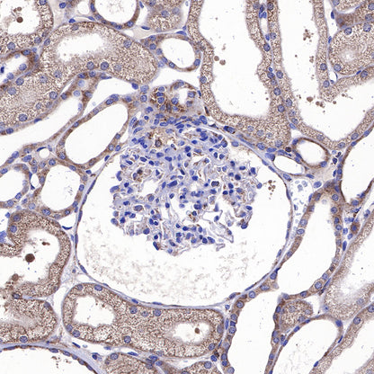 BAX Recombinant Rabbit mAb (SDT-338-76)