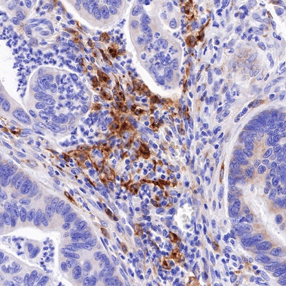 GPNMB Recombinant Rabbit mAb (S-R241)