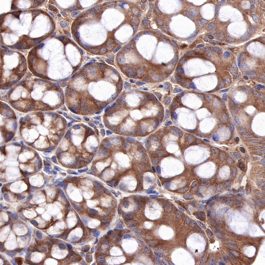 Hsp90 beta Recombinant Rabbit mAb (SDT-359-59)