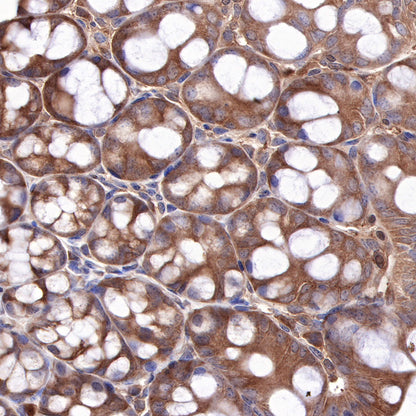 Hsp90 beta Recombinant Rabbit mAb (SDT-359-59)
