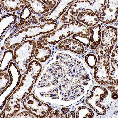 ATP5A Recombinant Rabbit mAb (S-1542-211)