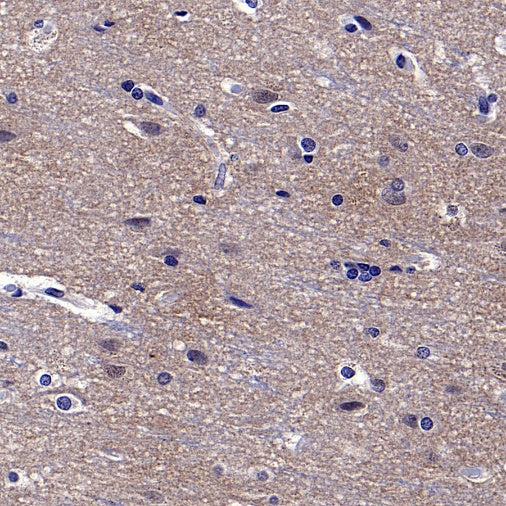 DARPP32 Recombinant Rabbit mAb (S-1637-62)