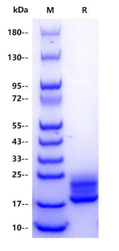 Mouse IL-17A Protein, His tag