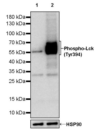 Phospho-Lck (Tyr394) Recombinant Rabbit mAb (S-1957-74)