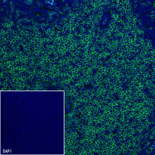 S-RMab®CD4 Recombinant Rabbit mAb (S-R569)