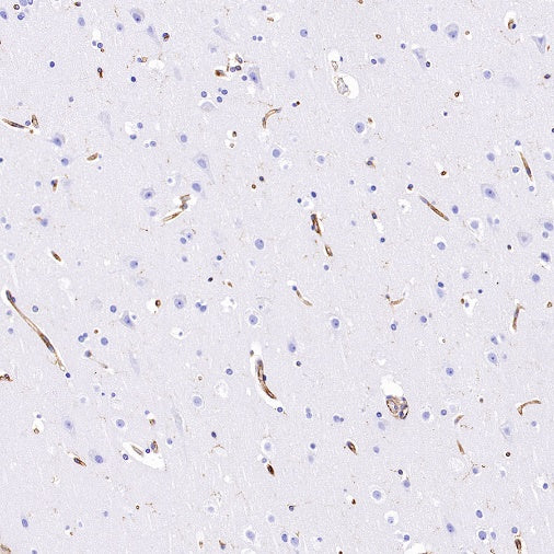 VISTA Recombinant Rabbit mAb (S-1013-5)