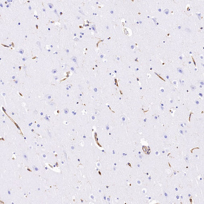 VISTA Recombinant Rabbit mAb (S-1013-5)