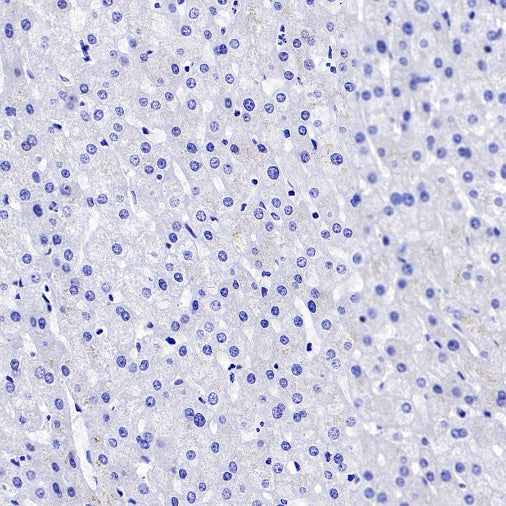 PRDM1/Blimp1 Recombinant Rabbit mAb (S-1972-3)