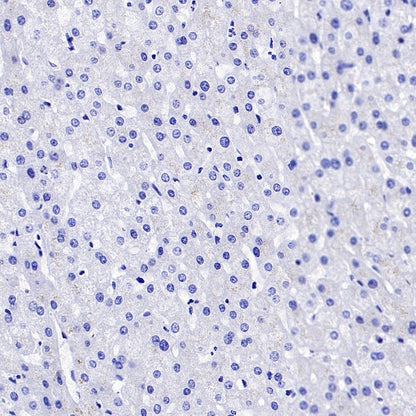 PRDM1/Blimp1 Recombinant Rabbit mAb (S-1972-3)