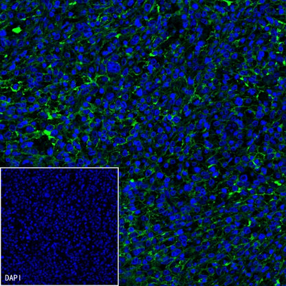 CD19 Recombinant Rabbit mAb (SDT-164-33)