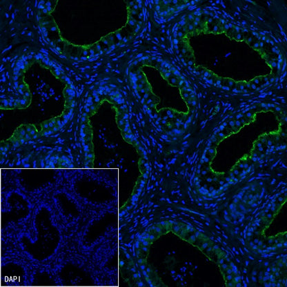 GPR64 Recombinant Rabbit mAb (S-1919-10)