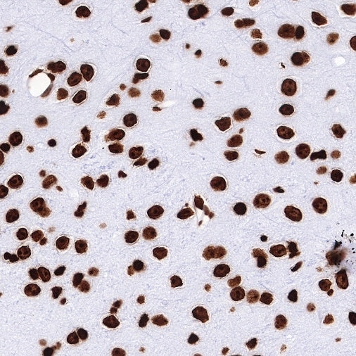 Histone H3 (tri methyl K27) Recombinant Rabbit mAb (SDT-431-118)