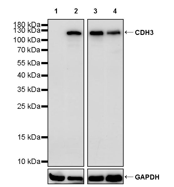 CDH3 Recombinant Rabbit mAb (S-3576-116)