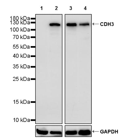 CDH3 Recombinant Rabbit mAb (S-3576-116)