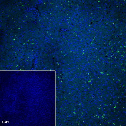 CD163 Recombinant Rabbit mAb (SDT-222-171)