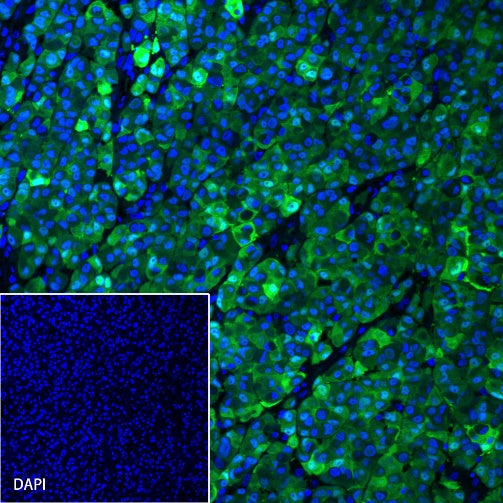 S100B Recombinant Rabbit mAb (Alexa Fluor® 488 Conjugate) (SDT-518-45)