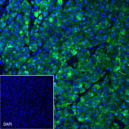 S100B Recombinant Rabbit mAb (Alexa Fluor® 488 Conjugate) (SDT-518-45)