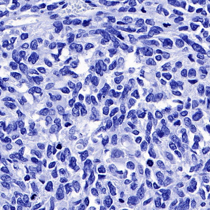 PLAP+ALPI Recombinant Rabbit mAb (SDT-167-155)