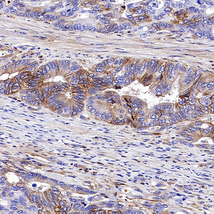 PTK7 Recombinant Rabbit mAb (SDT-2432-156)