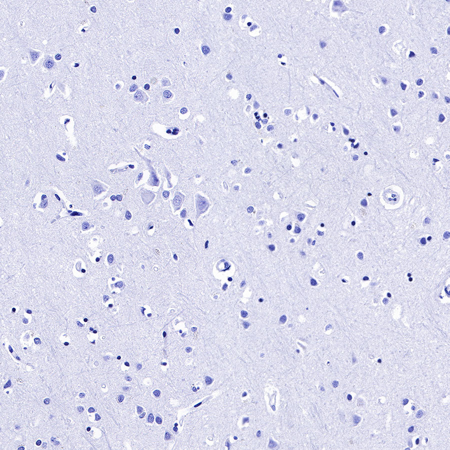 CGB/HCG-β Recombinant Rabbit mAb (SDT-228-46)
