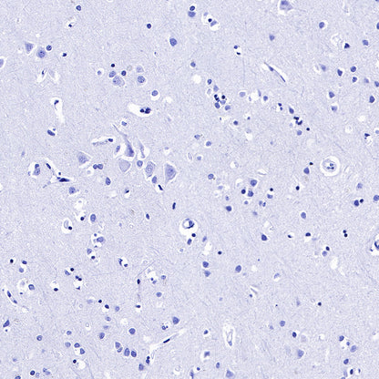 CGB/HCG-β Recombinant Rabbit mAb (SDT-228-46)