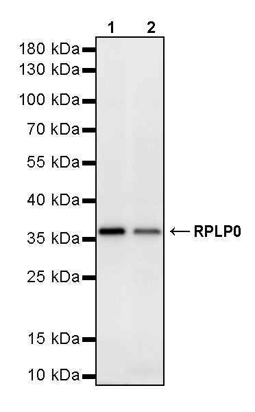 RPLP0 Rabbit Polyclonal Antibody