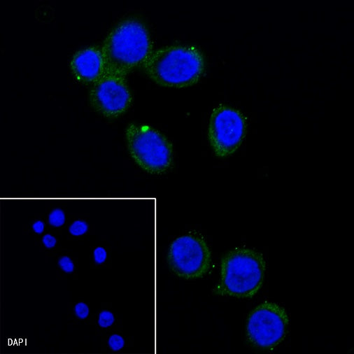 MLKL Recombinant Rat mAb (SDT-R195)
