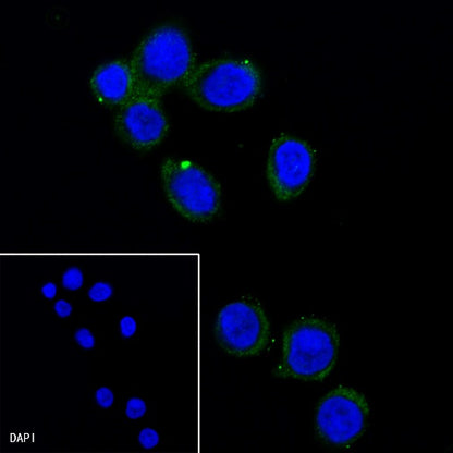 MLKL Recombinant Rat mAb (SDT-R195)