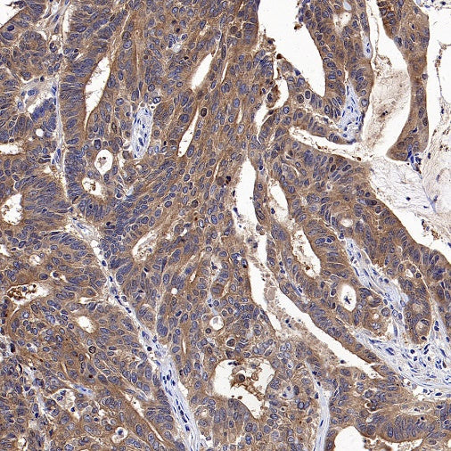 HPRT1 Rabbit Polyclonal Antibody