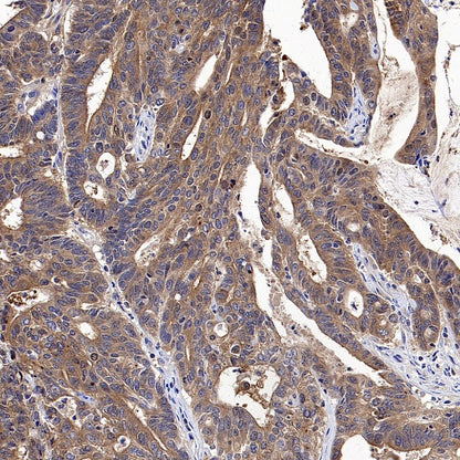 HPRT1 Rabbit Polyclonal Antibody