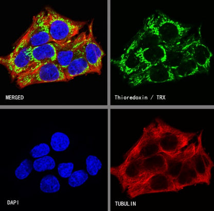 Thioredoxin/TRX Recombinant Rabbit mAb (S-1862-26)