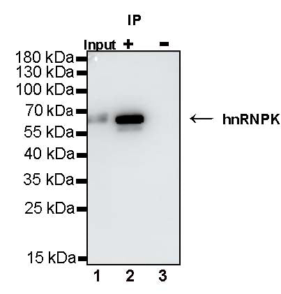 hnRNPK Recombinant Rabbit mAb (S-1645-45)