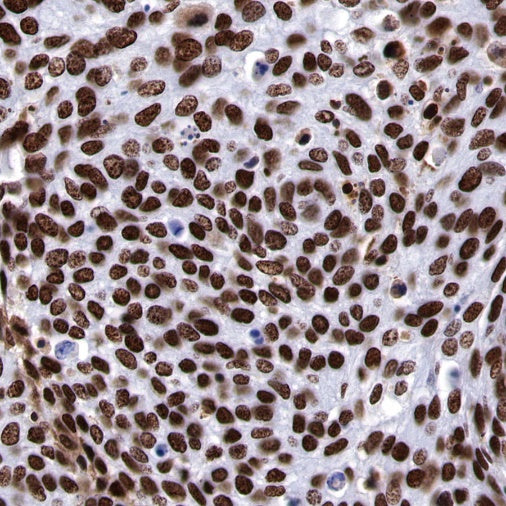PARP1 Recombinant Rabbit mAb (S-R299)