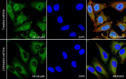 NF-κB p65 Recombinant Rabbit mAb (S-475-56)