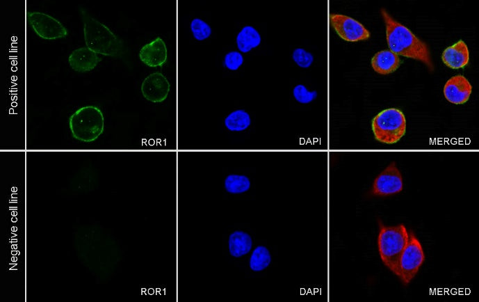 ROR1 Recombinant Rabbit mAb (SDT-R502-2)