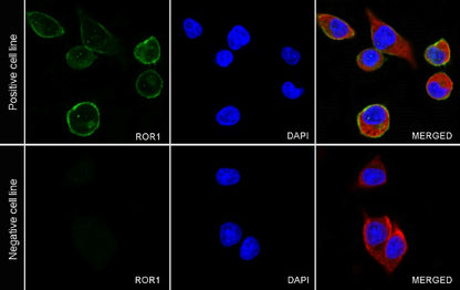 ROR1 Recombinant Rabbit mAb (SDT-R502-2)