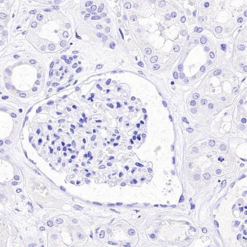 TdT Recombinant Mouse mAb (SDT-4203)