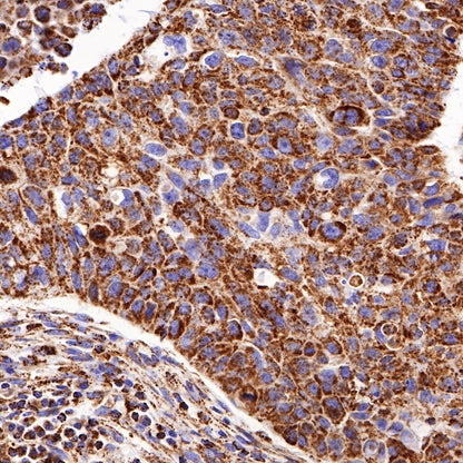 PBR/TSPO Recombinant Rabbit mAb (S-607-19)