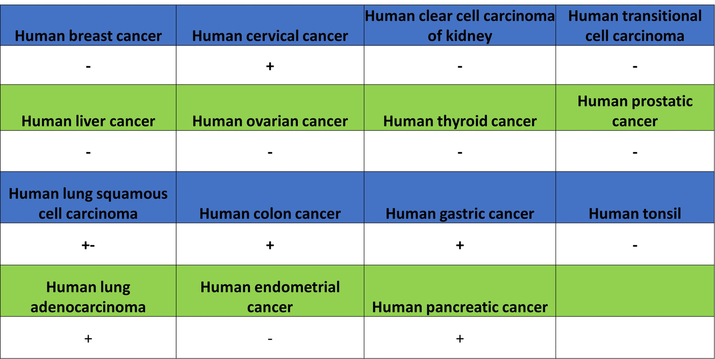 CEA Recombinant Rabbit mAb (SDT-098-63)