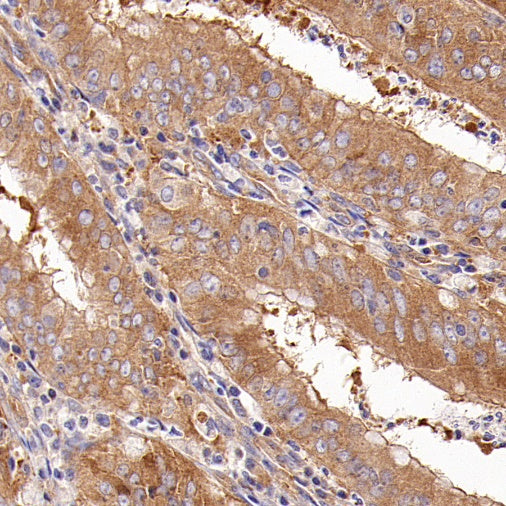 GPHN Recombinant Rabbit mAb (S-3167-63)