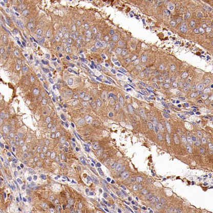 GPHN Recombinant Rabbit mAb (S-3167-63)