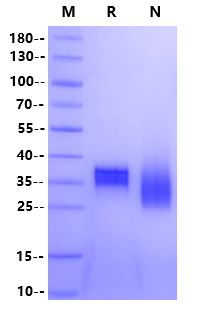 DR3/TNFRSF25 His Tag Protein, Human