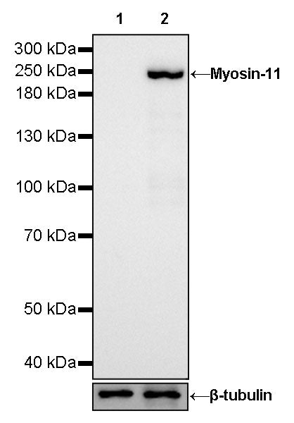 Myosin-11/SMMHC Recombinant Rabbit mAb,PBS Only (SDT-188-112)