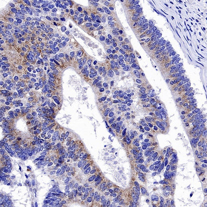 Pex14 Recombinant Rabbit mAb (S-2379-8)