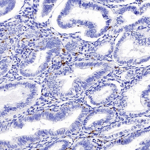 CD94 Recombinant Rabbit mAb (S-2616-5)